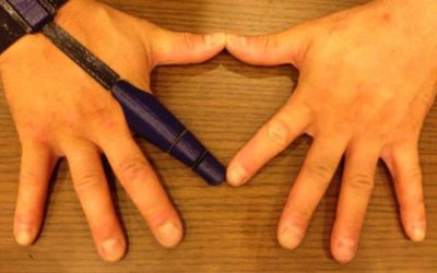 Australijanac poklanja 3d štampane proteze „Kinetic Finger“